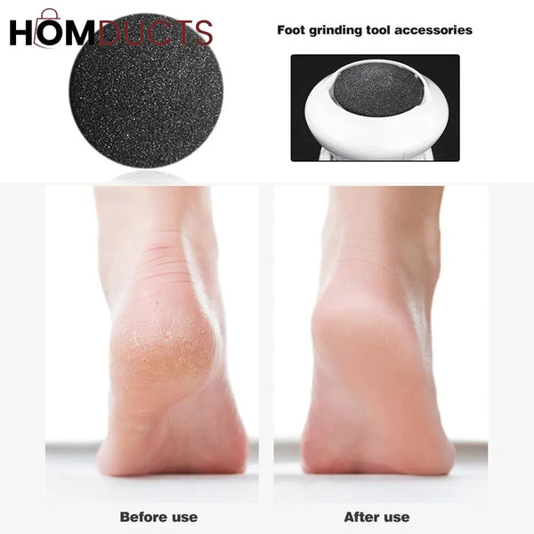 Electric Callus Remover For Feet